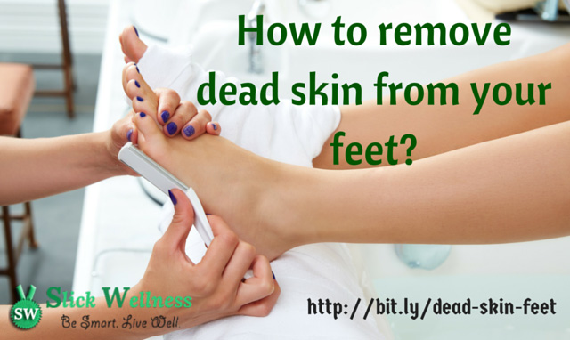 How To Remove Dead Skin From Feet Quickly