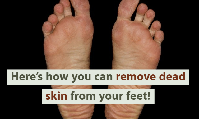 Heres How You Can Remove Dead Skin From Your Feet