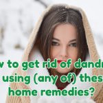 40 Home remedies to get rid of dandruff fast