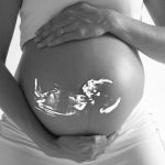 Benefits and Risks of Ultrasound During Pregnancy 1