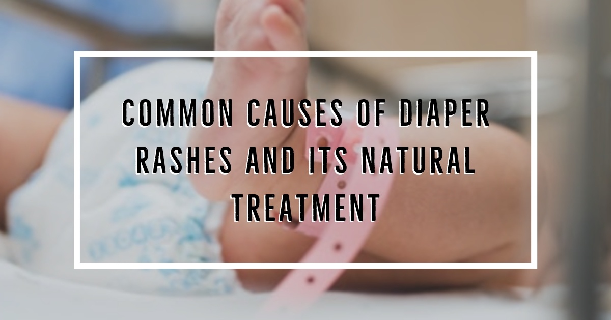 Common causes of diaper rashes and its natural treatment