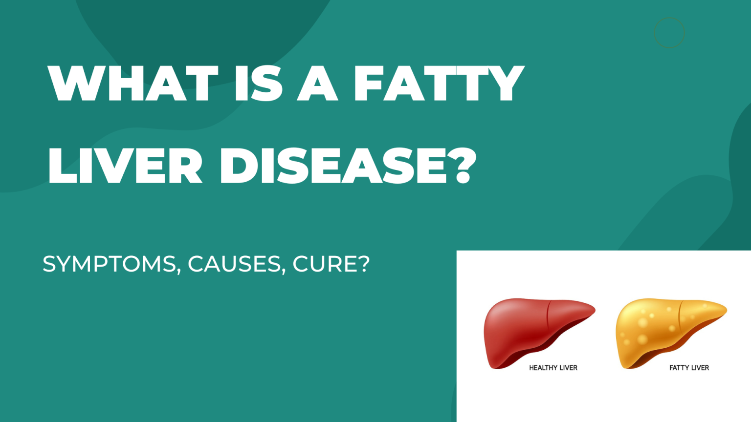 What Is A Fatty Liver Disease? What Are The Causes? What Are The ...